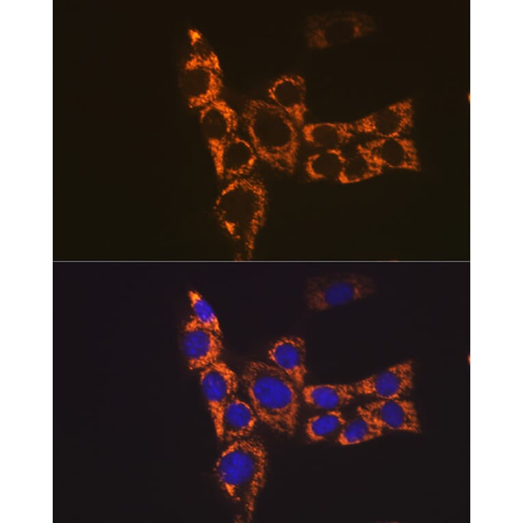 Immunofluorescence - Anti-H2-Ab1 Antibody (A308638) - Antibodies.com