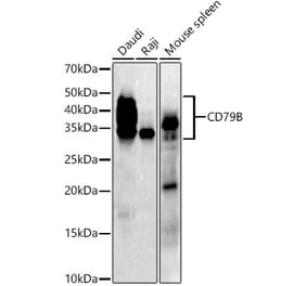 Western Blot - Anti-CD79b Antibody [ARC52683] (A308639) - Antibodies.com