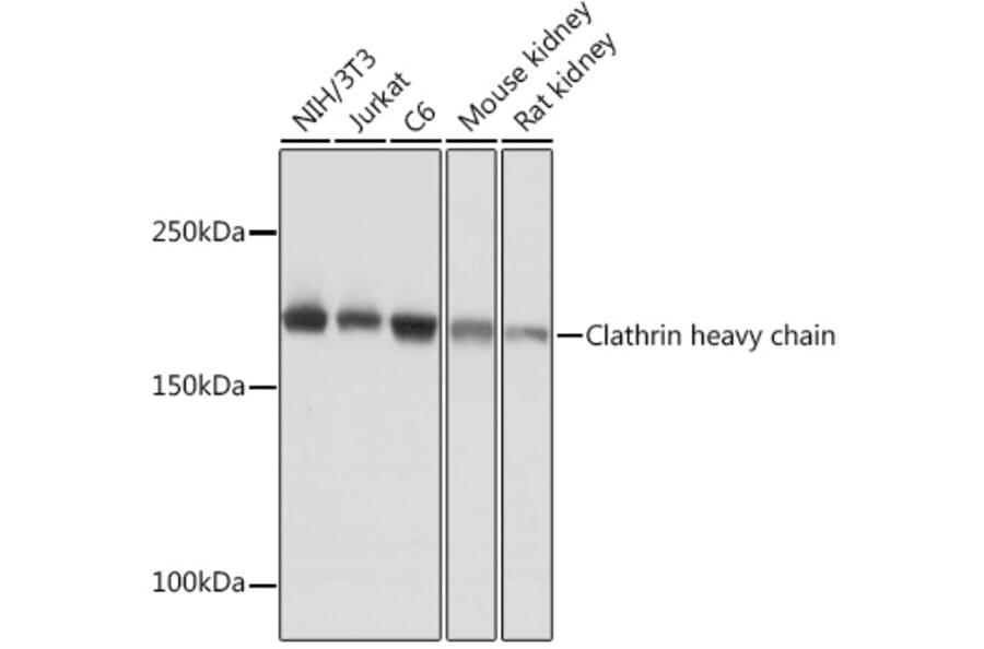 Western Blot - Anti-Clathrin heavy chain Antibody [ARC1228] (A308642) - Antibodies.com