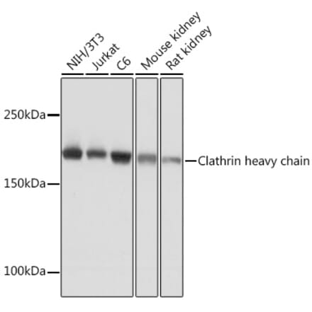 Western Blot - Anti-Clathrin heavy chain Antibody [ARC1228] (A308642) - Antibodies.com