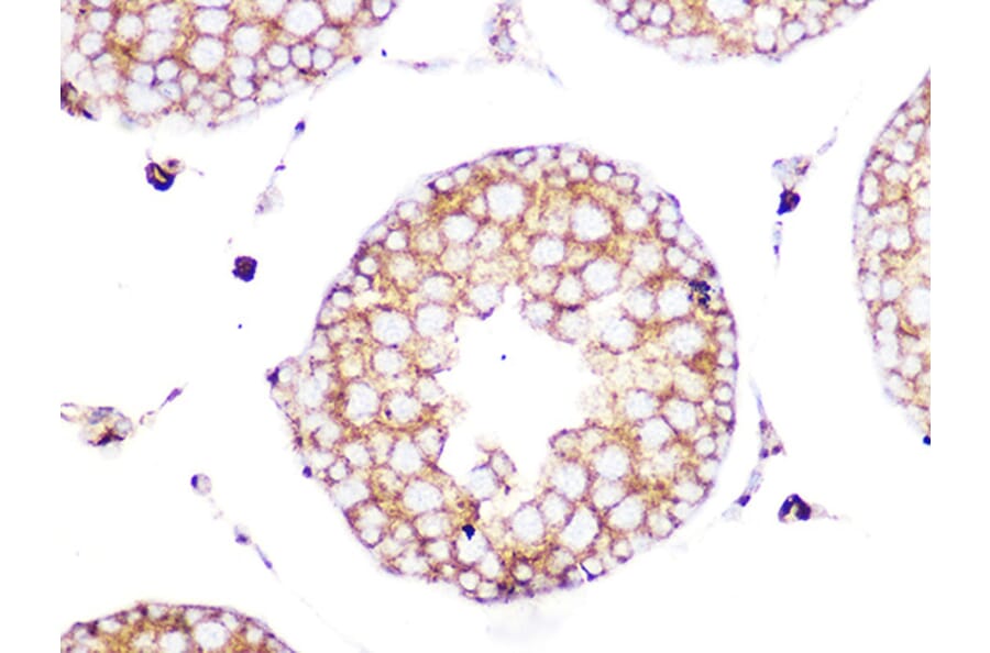 Immunohistochemistry - Anti-Clathrin heavy chain Antibody [ARC1228] (A308642) - Antibodies.com