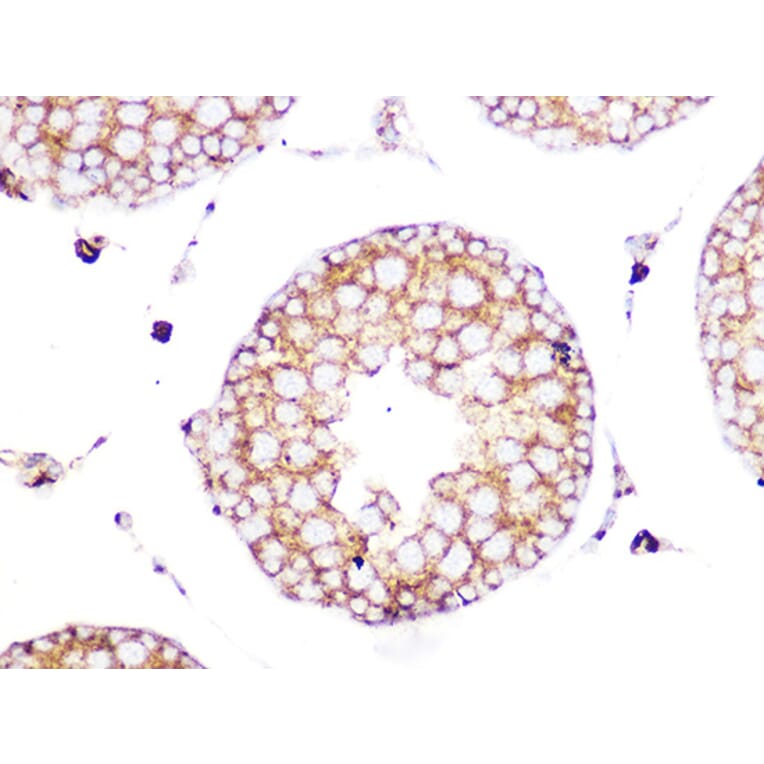 Immunohistochemistry - Anti-Clathrin heavy chain Antibody [ARC1228] (A308642) - Antibodies.com