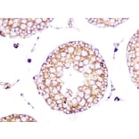 Immunohistochemistry - Anti-Clathrin heavy chain Antibody [ARC1228] (A308642) - Antibodies.com