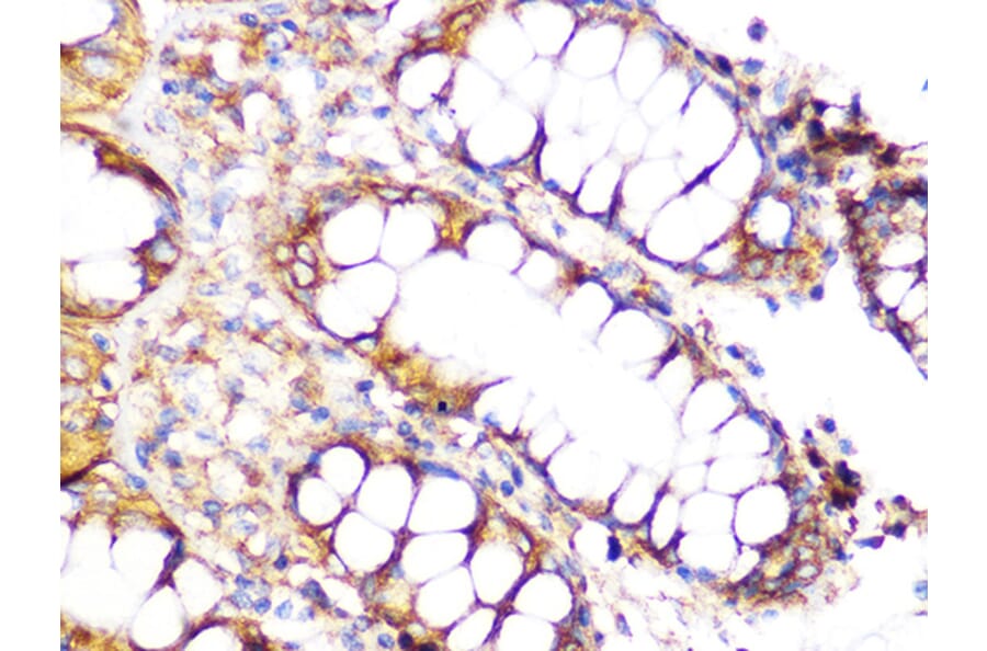 Immunohistochemistry - Anti-Clathrin heavy chain Antibody [ARC1228] (A308642) - Antibodies.com