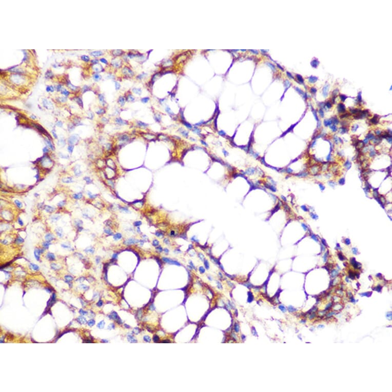 Immunohistochemistry - Anti-Clathrin heavy chain Antibody [ARC1228] (A308642) - Antibodies.com