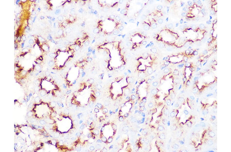Immunohistochemistry - Anti-Clathrin heavy chain Antibody [ARC1228] (A308642) - Antibodies.com