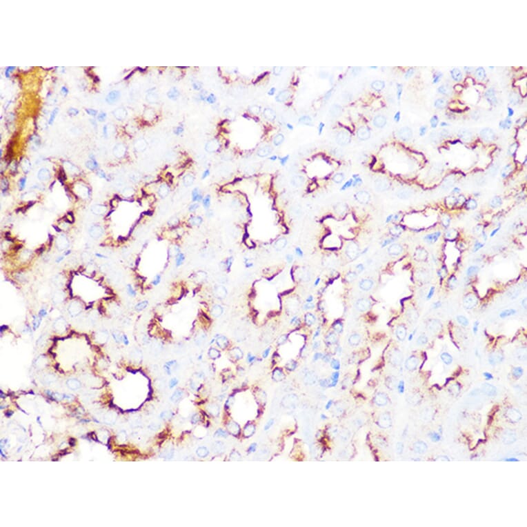 Immunohistochemistry - Anti-Clathrin heavy chain Antibody [ARC1228] (A308642) - Antibodies.com