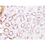 Immunohistochemistry - Anti-Clathrin heavy chain Antibody [ARC1228] (A308642) - Antibodies.com
