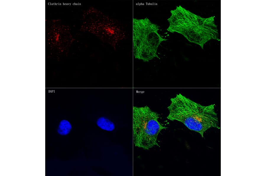 Immunofluorescence - Anti-Clathrin heavy chain Antibody [ARC1228] (A308642) - Antibodies.com