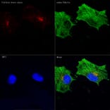 Immunofluorescence - Anti-Clathrin heavy chain Antibody [ARC1228] (A308642) - Antibodies.com