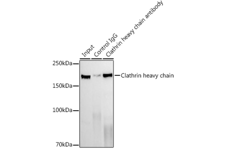 Western Blot - Anti-Clathrin heavy chain Antibody [ARC1228] (A308642) - Antibodies.com