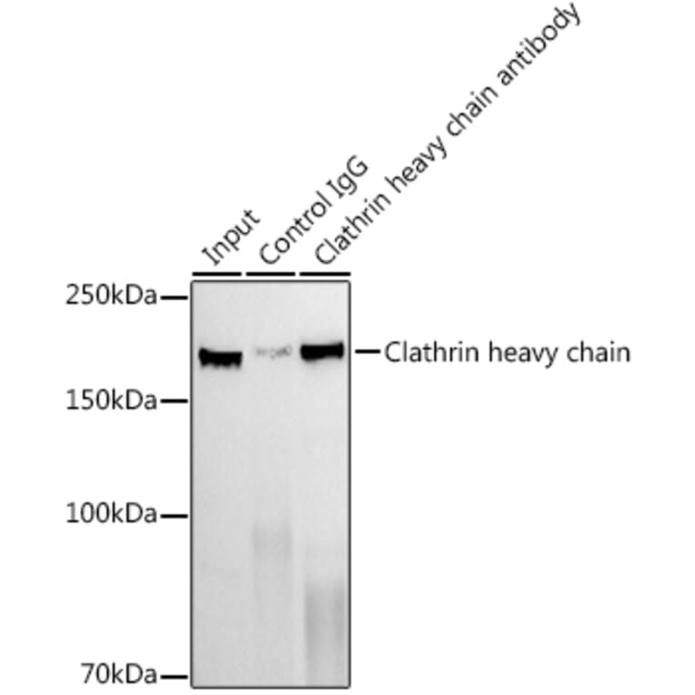 Western Blot - Anti-Clathrin heavy chain Antibody [ARC1228] (A308642) - Antibodies.com