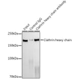 Western Blot - Anti-Clathrin heavy chain Antibody [ARC1228] (A308642) - Antibodies.com