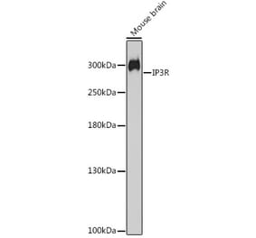 Western Blot - Anti-IP3 receptor Antibody (A308643) - Antibodies.com