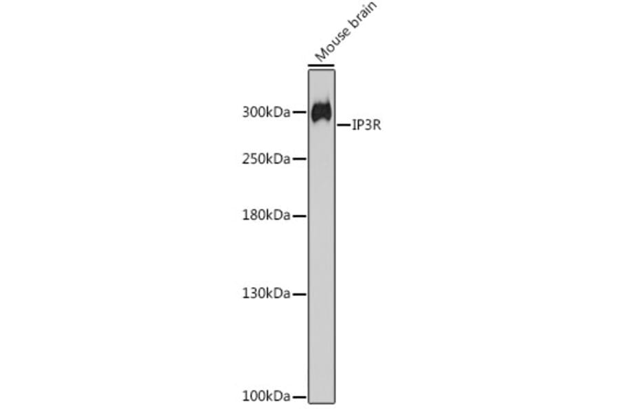 Western Blot - Anti-IP3 receptor Antibody (A308643) - Antibodies.com