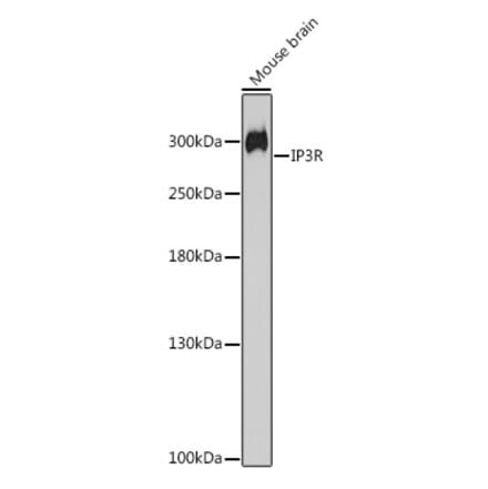 Western Blot - Anti-IP3 receptor Antibody (A308643) - Antibodies.com