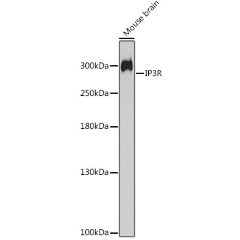 Western Blot - Anti-IP3 receptor Antibody (A308643) - Antibodies.com