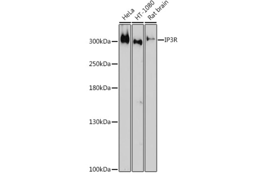 Western Blot - Anti-IP3 receptor Antibody (A308643) - Antibodies.com