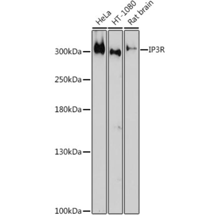 Western Blot - Anti-IP3 receptor Antibody (A308643) - Antibodies.com