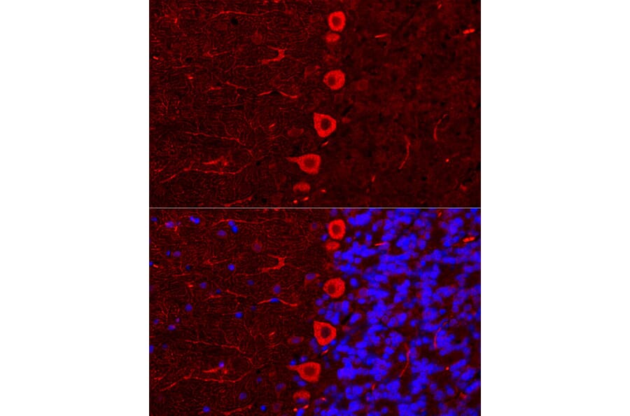 Immunofluorescence - Anti-IP3 receptor Antibody (A308643) - Antibodies.com