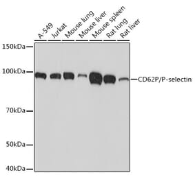 Western Blot - Anti-P-Selectin Antibody [ARC1229] (A308646) - Antibodies.com