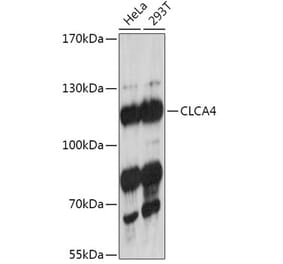 Western Blot - Anti-CLCA4 Antibody (A308647) - Antibodies.com