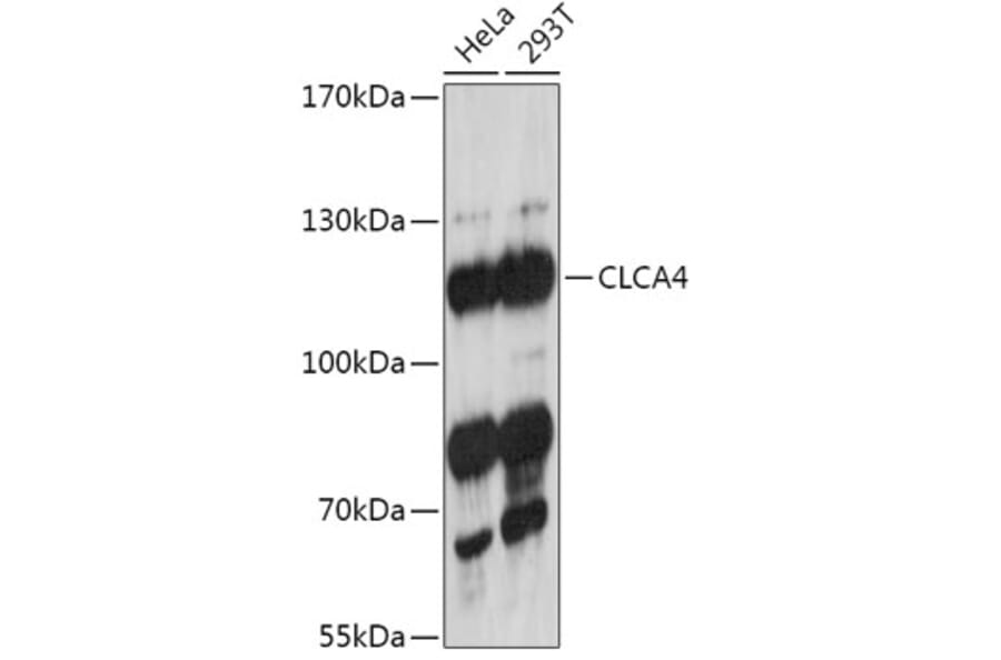 Western Blot - Anti-CLCA4 Antibody (A308647) - Antibodies.com