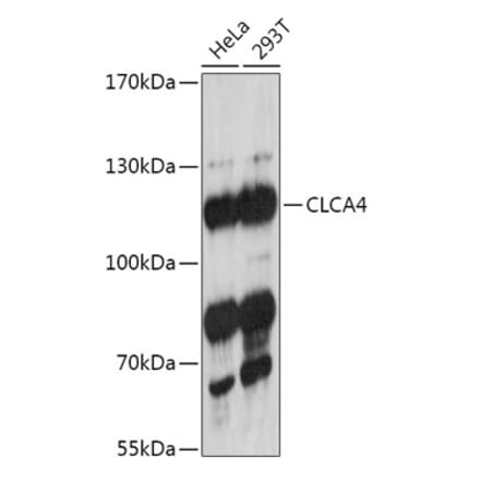 Western Blot - Anti-CLCA4 Antibody (A308647) - Antibodies.com