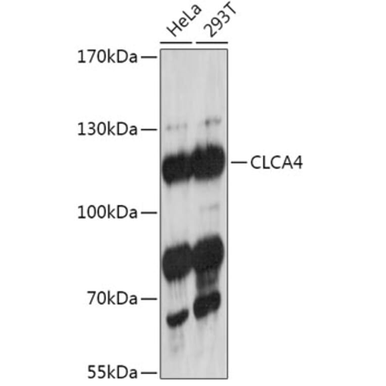 Western Blot - Anti-CLCA4 Antibody (A308647) - Antibodies.com