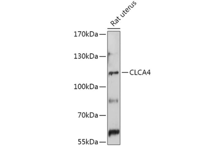 Western Blot - Anti-CLCA4 Antibody (A308647) - Antibodies.com