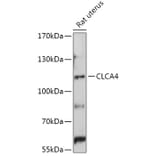 Western Blot - Anti-CLCA4 Antibody (A308647) - Antibodies.com