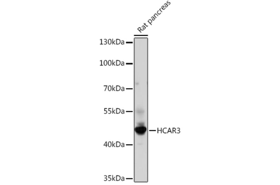 Western Blot - Anti-HCAR3 Antibody (A308649) - Antibodies.com