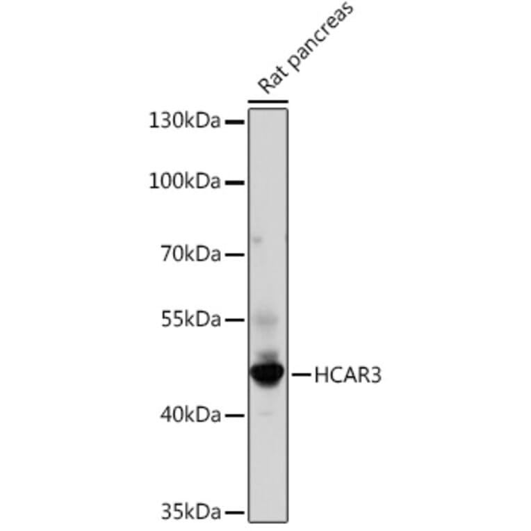 Western Blot - Anti-HCAR3 Antibody (A308649) - Antibodies.com
