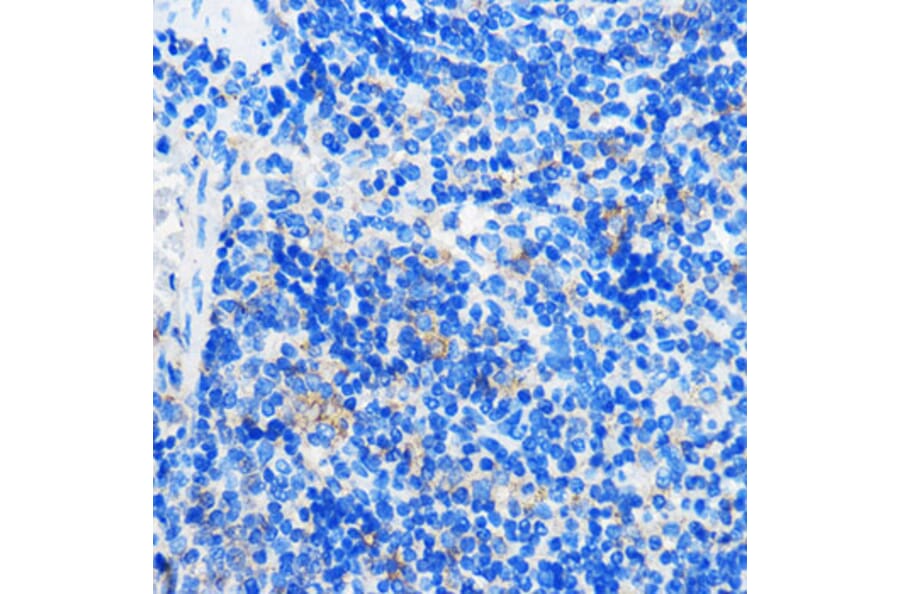 Immunohistochemistry - Anti-HCAR3 Antibody (A308649) - Antibodies.com