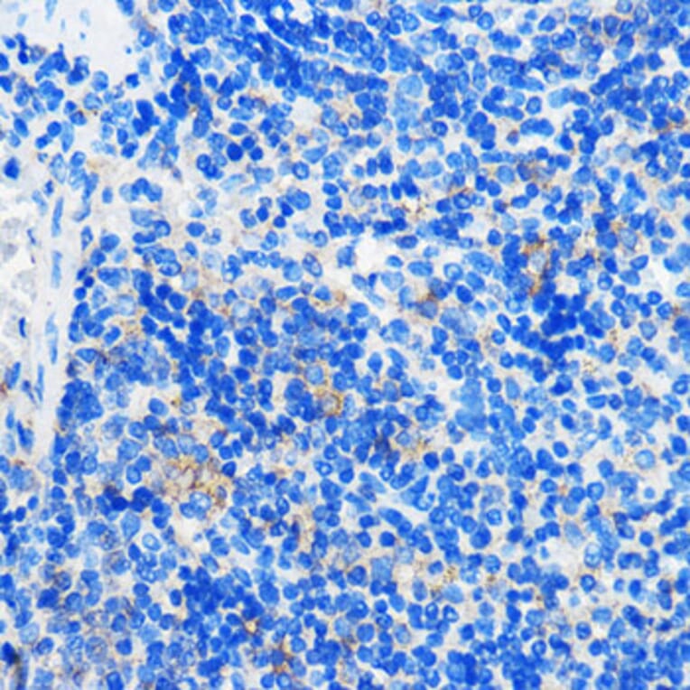 Immunohistochemistry - Anti-HCAR3 Antibody (A308649) - Antibodies.com