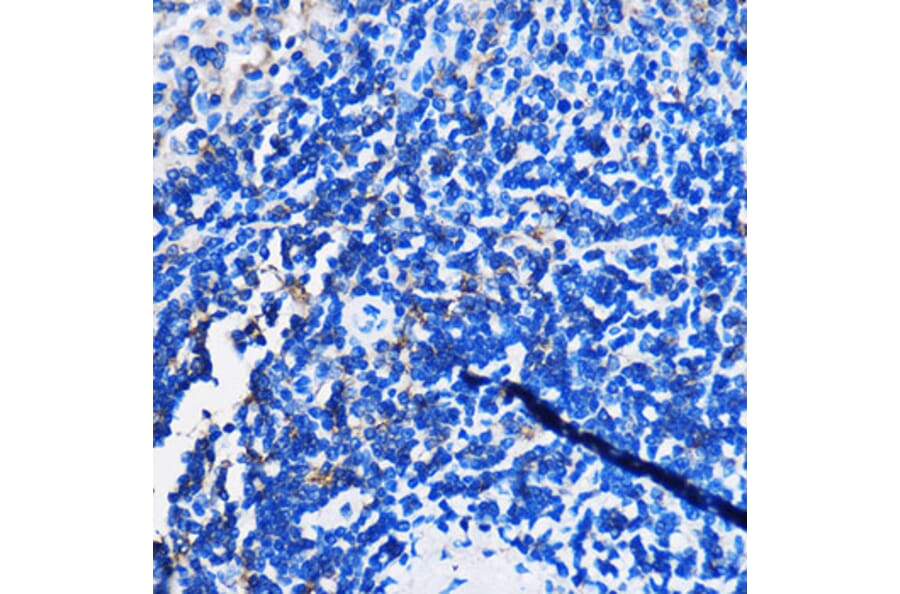 Immunohistochemistry - Anti-HCAR3 Antibody (A308649) - Antibodies.com