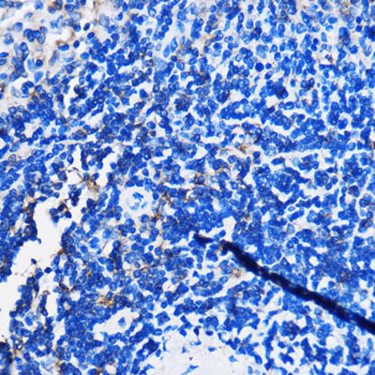 Immunohistochemistry - Anti-HCAR3 Antibody (A308649) - Antibodies.com