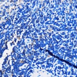 Immunohistochemistry - Anti-HCAR3 Antibody (A308649) - Antibodies.com