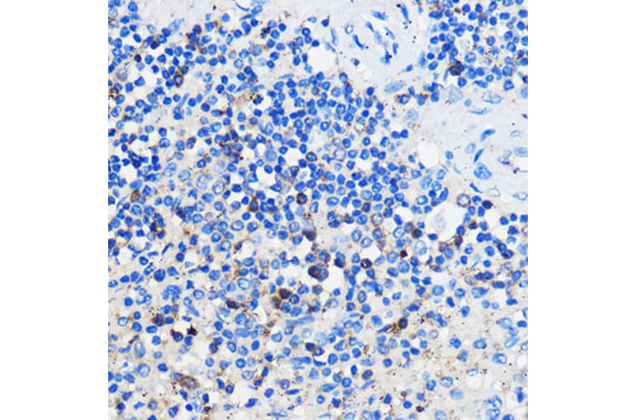 Immunohistochemistry - Anti-HCAR3 Antibody (A308649) - Antibodies.com