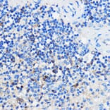 Immunohistochemistry - Anti-HCAR3 Antibody (A308649) - Antibodies.com