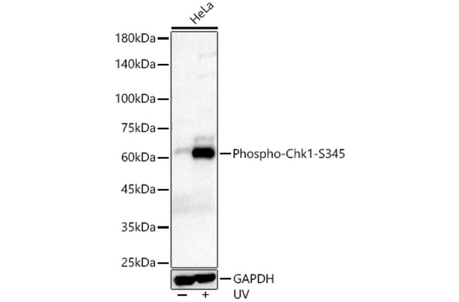 Western Blot - Anti-Chk1 (phospho Ser345) Antibody [ARC56803] (A308650) - Antibodies.com