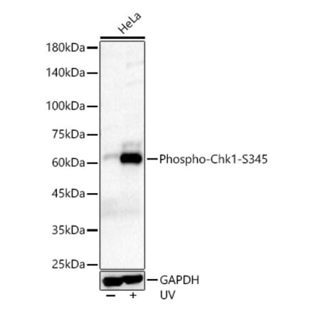 Western Blot - Anti-Chk1 (phospho Ser345) Antibody [ARC56803] (A308650) - Antibodies.com