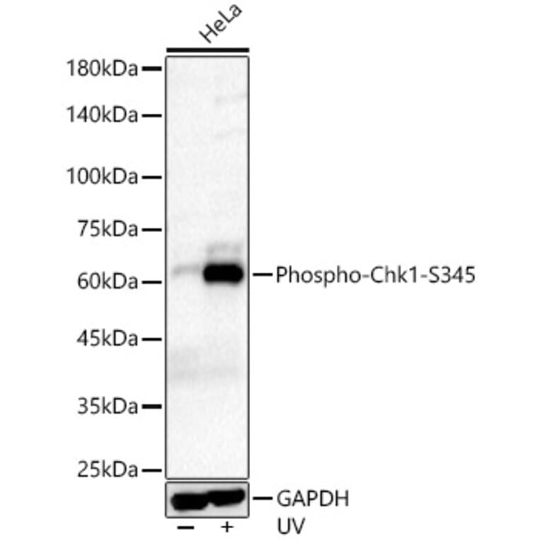 Western Blot - Anti-Chk1 (phospho Ser345) Antibody [ARC56803] (A308650) - Antibodies.com