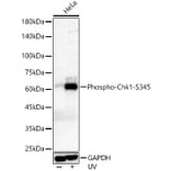 Western Blot - Anti-Chk1 (phospho Ser345) Antibody [ARC56803] (A308650) - Antibodies.com