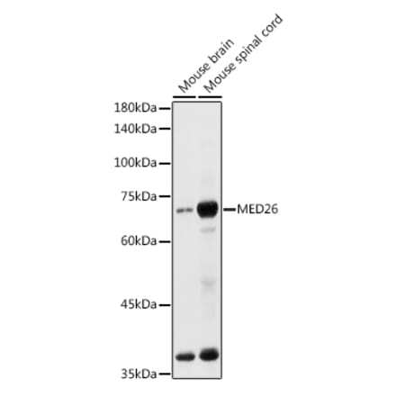 Western Blot - Anti-MED26 Antibody (A308652) - Antibodies.com