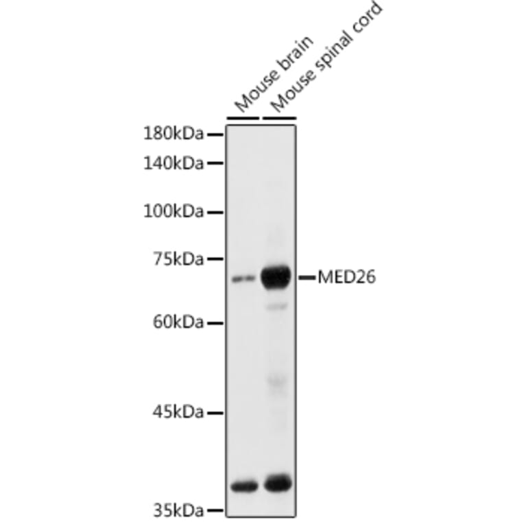 Western Blot - Anti-MED26 Antibody (A308652) - Antibodies.com