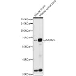 Western Blot - Anti-MED26 Antibody (A308652) - Antibodies.com