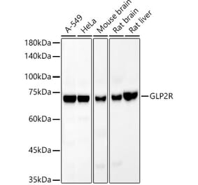 Western Blot - Anti-GLP2R Antibody [ARC54969] (A308653) - Antibodies.com