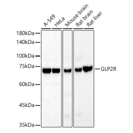 Western Blot - Anti-GLP2R Antibody [ARC54969] (A308653) - Antibodies.com