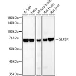 Western Blot - Anti-GLP2R Antibody [ARC54969] (A308653) - Antibodies.com